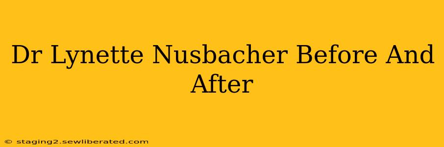 Dr Lynette Nusbacher Before And After